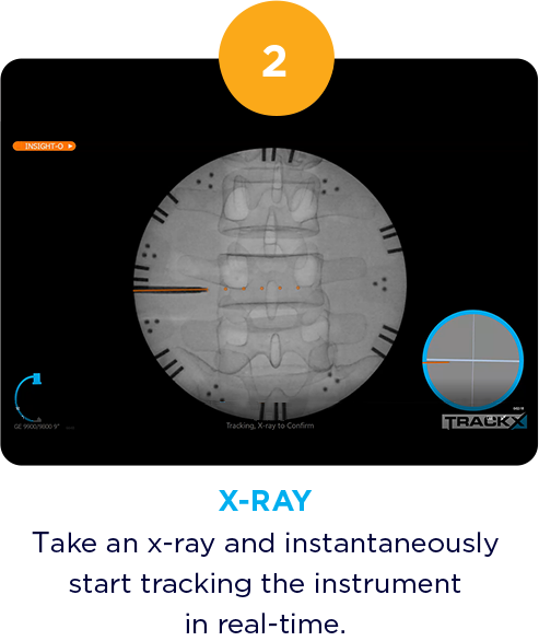 Take an x-ray and instantaneously start tracking the instrument in real-time.